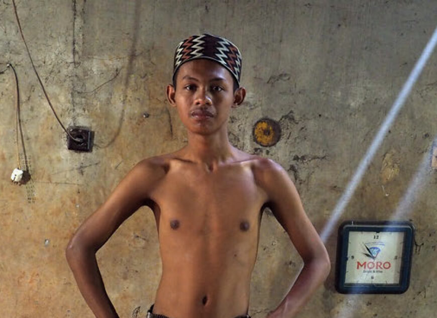 Children’s Exposure to Lead Pollution Undermines a Generation of Future Potential